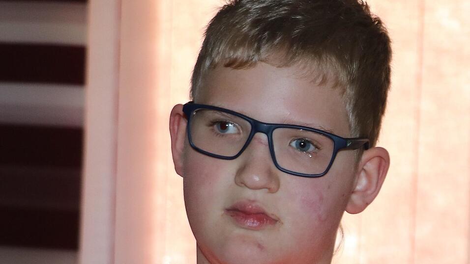 Der elfj&auml;hrige Johannes - hier ein Archivbild von unserem Besuch bei ihm daheim im August 2019 - wollte am Montag vor Gericht aussagen. An den Unfall selbst kann er sich jedoch nicht mehr erinnern.