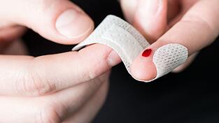 Kleinere Hautwunden verheilen meist in wenigen Tagen. Wichtig ist, dass sie nicht verschmutzen.