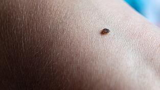 Bettwanzen ernähren sich von menschlichem Blut, sind aber harmlos.