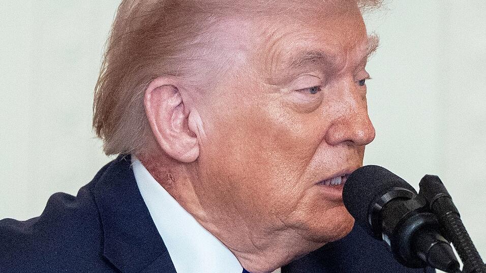 Eine Stelle an Trumps Hals hat eine Welle von Spekulationen über die Gesundheit des Präsidenten ausgelöst. Eine Stelle an Trumps Hals hat eine Welle von Spekulationen über die Gesundheit des Präsidenten ausgelöst.