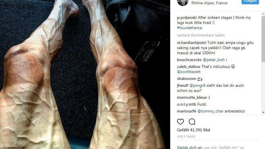 Mit diesem Foto seiner Beine sorgt der Radprofi Pawel Poljanski gerade für Aufsehen in den sozialen Netzwerken. Mit diesem Foto seiner Beine sorgt der Radprofi Pawel Poljanski gerade für Aufsehen in den sozialen Netzwerken.