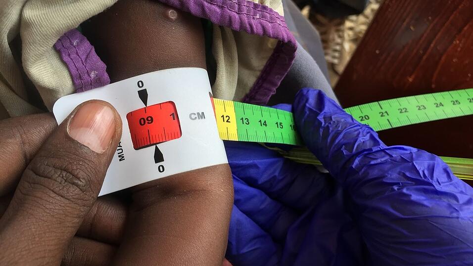 Schon jetzt gelten fast zwei Millionen Kinder in Somalia akut unterernährt. (Archivbild) Schon jetzt gelten fast zwei Millionen Kinder in Somalia akut unterernährt. (Archivbild)