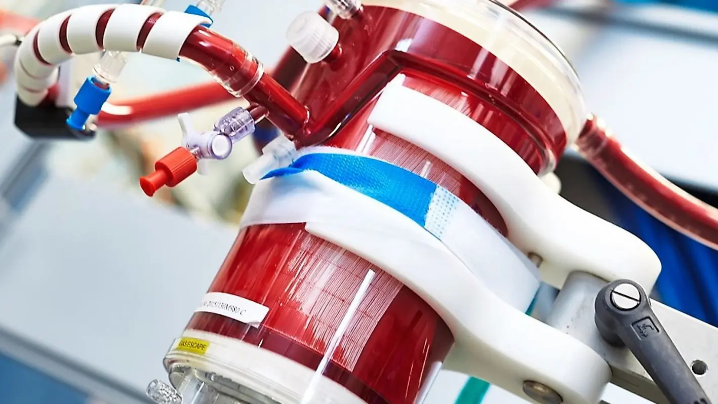 Uniklinik Regensburg: Ecmo rettet Covid-Patienten
