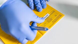 Eine Infektion mit Hepatitis B kann zu Leberzirrhose und Krebs führen - eine Impfung schützt (Symbolbild).