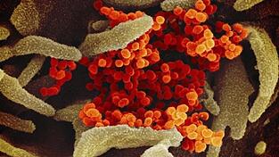 So sieht das Coronavirus unter dem Elektronenmikroskop aus. So sieht das Coronavirus unter dem Elektronenmikroskop aus.