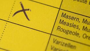 In einem Schnellrestaurant im Landkreis Erding gibt es einen Masernfall (Archivbild)