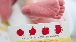 Die Gesundheitsministerin betont die Bedeutung des Neugeborenen-Screenings. (Symbolbild) Die Gesundheitsministerin betont die Bedeutung des Neugeborenen-Screenings. (Symbolbild)