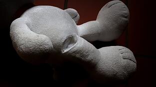 Ob das Kind bleibende Sch&auml;den hat, ist noch ungewiss. (Symbolbild)