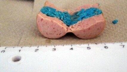 In Landshut sind am Wochenende mehrere Giftk&ouml;der aufgetaucht. Die Wurstst&uuml;cke wurden offenbar mit Rattengift versehen. (Foto: Polizei)