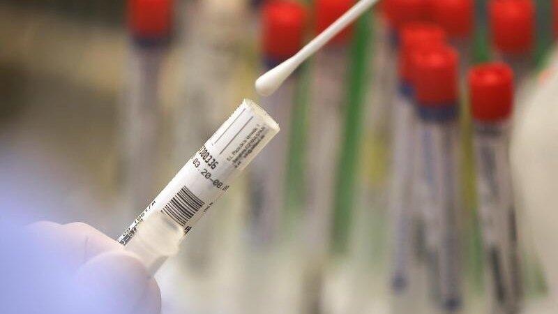 Ein Abstrich wird in einem Labor auf das Coronavirus untersucht.