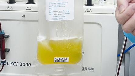 Bisher gibt es kein Medikament gegen die Lungenkrankheit Covid-19. Das Blutplasma von ehemaligen Patienten, das Antikörper gegen das neue Coronavirus enthält, darf nun testweise in Kliniken eingesetzt werden.