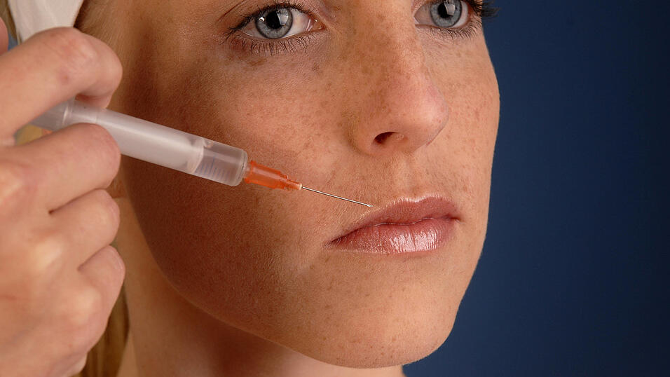 Einige Frauen lie&szlig;en sich bei der Angeklagten die Lippen unterspritzen - das ging ordentlich schief. Deshalb muss sich die Angeklagte nun vor Gericht verantworten. (Symbolbild)