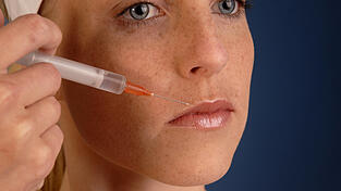 Einige Frauen lie&szlig;en sich bei der Angeklagten die Lippen unterspritzen - das ging ordentlich schief. Deshalb muss sich die Angeklagte nun vor Gericht verantworten. (Symbolbild)