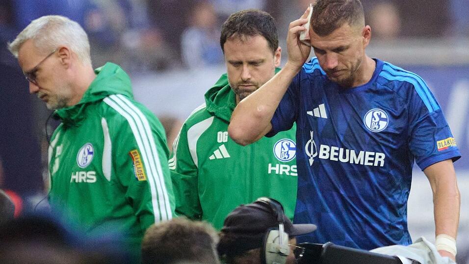 Gebrauchter Tag für Edin Dzeko und Schalke 04. Gebrauchter Tag für Edin Dzeko und Schalke 04.