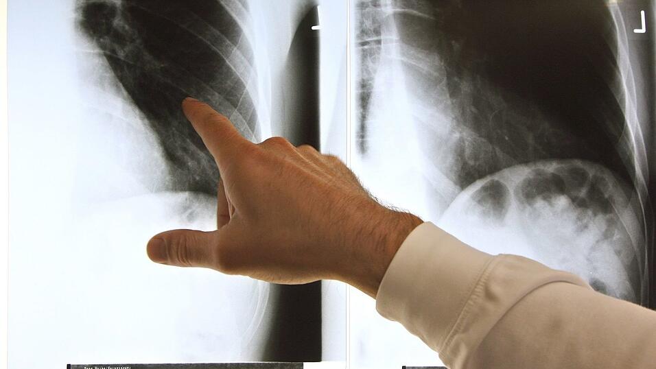 Patientensch&uuml;tzer sind &uuml;ber die geplanten Neuregelungen bei der &Auml;rztewahl besorgt. (Archivbild)