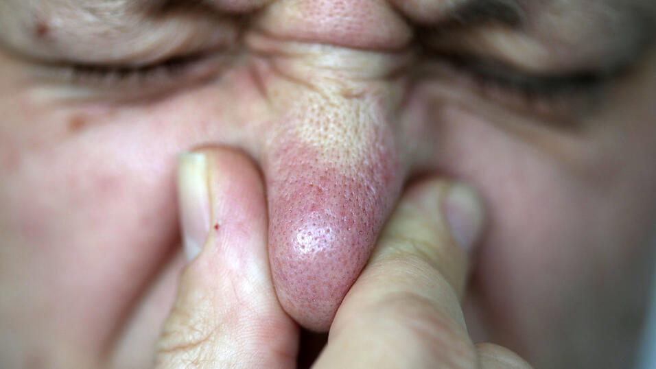 Ganz sch&ouml;n eklig war der Gestank, der sich im Raum Mainburg vergangene Woche ausbreitete. Da konnte man sich nur die Nase zuhalten.