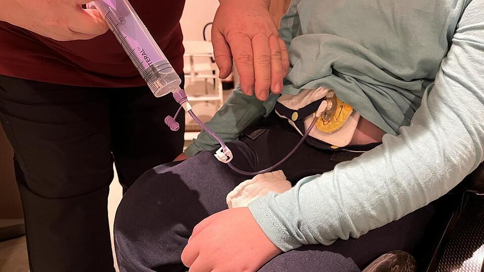 Sara (7) bekommt ihre Medikamente flüssig über ihre Buttonsonde.