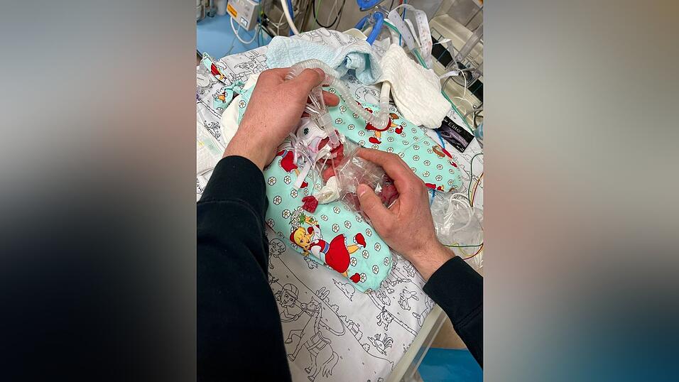 Etwas mehr als ein Päckchen Butter wog die kleine Marie, als sie im Februar zur Welt kam. Seitdem ist das Kind gut gewachsen. Etwas mehr als ein Päckchen Butter wog die kleine Marie, als sie im Februar zur Welt kam. Seitdem ist das Kind gut gewachsen.