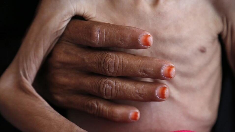 Viele von der Hungerkrise betroffene Länder machen keine Fortschritte bei der Verbesserung der Lage. Viele von der Hungerkrise betroffene Länder machen keine Fortschritte bei der Verbesserung der Lage.