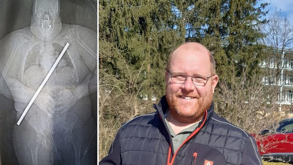 Auf dem Röntgenbild ist die Eisenstange, die Jürgen Mayr-Steffeldemel durchbohrt hat, gut zu erkennen. Heute geht es dem 40-Jährigen gesundheitlich wieder gut - er hat keine Beschwerden mehr. Auf dem Röntgenbild ist die Eisenstange, die Jürgen Mayr-Steffeldemel durchbohrt hat, gut zu erkennen. Heute geht es dem 40-Jährigen gesundheitlich wieder gut - er hat keine Beschwerden mehr.