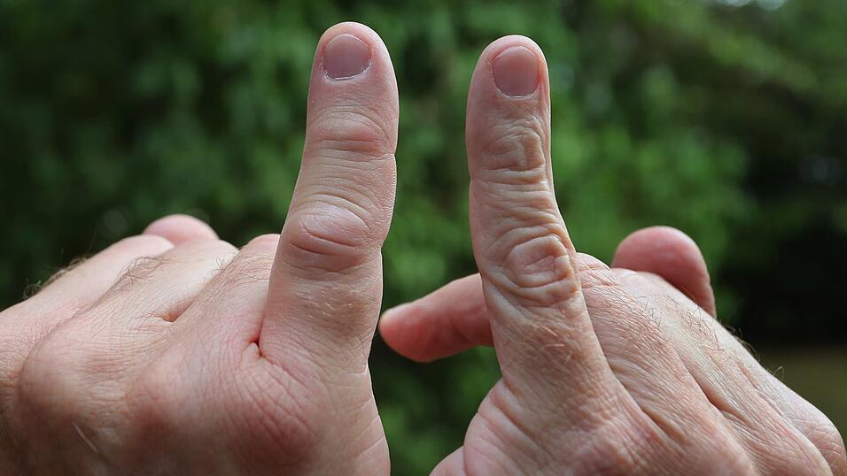 Das Gift von Wespe, Biene und Hornisse kann Entzündungsreaktionen mit Rötung, Schwellung und Schmerzen auslösen.