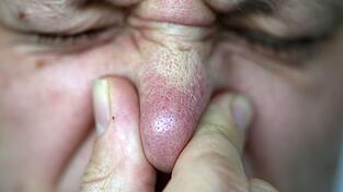 Die Abgasuntersuchung ergab laut dem Landratsamt, dass eine Gesundheitsgefährdung nicht besteht. (Symbolbild) Die Abgasuntersuchung ergab laut dem Landratsamt, dass eine Gesundheitsgefährdung nicht besteht. (Symbolbild)