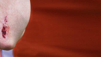 Bei Freistunde erfahrt ihr, wie Wundheilung funktioniert.