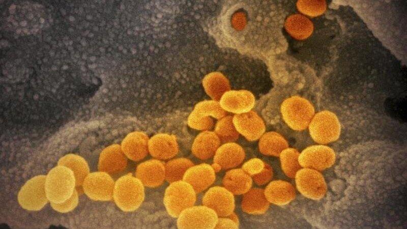 Das winzige Coronavirus hat ein riesiges Kreuzfahrtschiff zum Stillstand gebracht - insgesamt wurden 80 Infektionen bei Passagieren nachgewiesen. (Symbolbild) Das winzige Coronavirus hat ein riesiges Kreuzfahrtschiff zum Stillstand gebracht - insgesamt wurden 80 Infektionen bei Passagieren nachgewiesen. (Symbolbild)