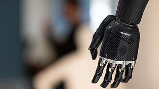 Handprothese im Showroom von Ottobock in Duderstadt. Der Orthopädietechnikhersteller geht an die Börse.