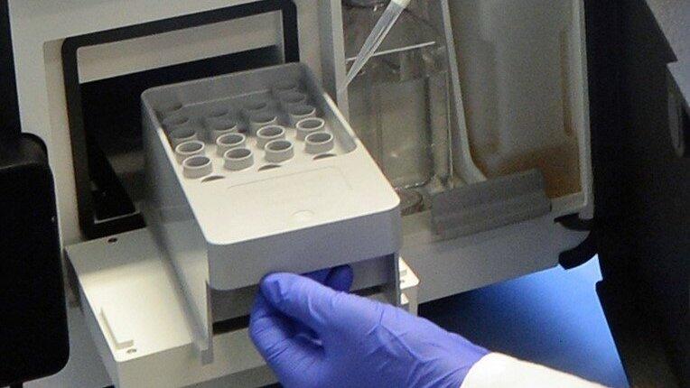 In den kommenden sechs Jahren arbeiten Wissenschaftler aus ganz Deutschland eng zusammen, um Knochenmetastasen nach einer vorherigen Brust- oder Prostatakrebserkrankung fr&uuml;hzeitig zu erkennen und deren Entstehung zu verhindern. (Symbolbild)