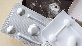 Zum ersten Mal wurde bei Schwangerschaftsabbr&uuml;chen das Medikament Mifegyne h&auml;ufiger genutzt als die Absaugmethode. (Archivbild)