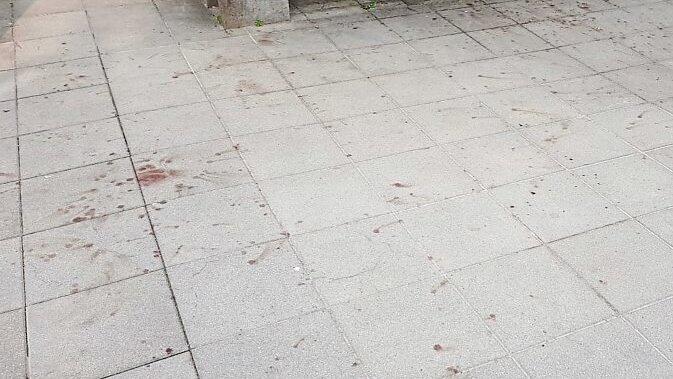 Selbst nach eingehender Reinigung blieb eine Blutspur zurück. Selbst nach eingehender Reinigung blieb eine Blutspur zurück.