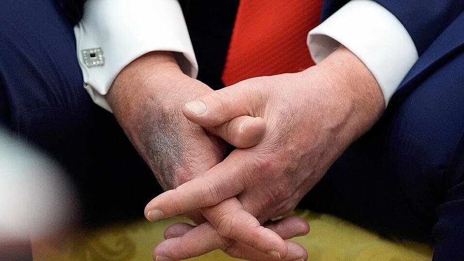 Blaue Flecken geben immer wieder Anlass f&uuml;r Spekulationen. (Archivbild)