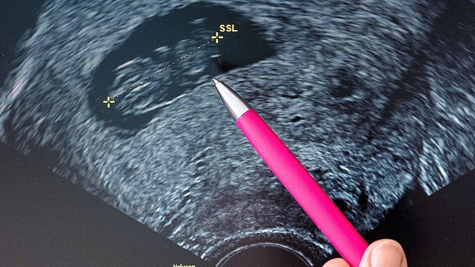 Eine Frauenärztin deutet auf einen Fötus auf einer Ultraschall-Aufnahme. Ein Schwangerschaftsabbruch bleibt unter bestimmten Voraussetzungen innerhalb der ersten zwölf Wochen straffrei. Eine Frauenärztin deutet auf einen Fötus auf einer Ultraschall-Aufnahme. Ein Schwangerschaftsabbruch bleibt unter bestimmten Voraussetzungen innerhalb der ersten zwölf Wochen straffrei.