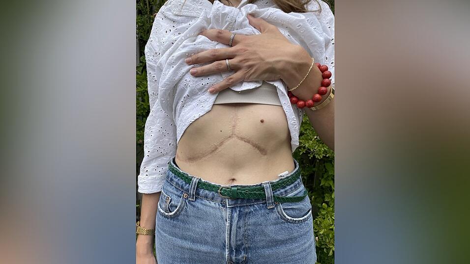 Lizzis Narbe sieht aus wie ein Mercedes-Stern. Lizzis Narbe sieht aus wie ein Mercedes-Stern.